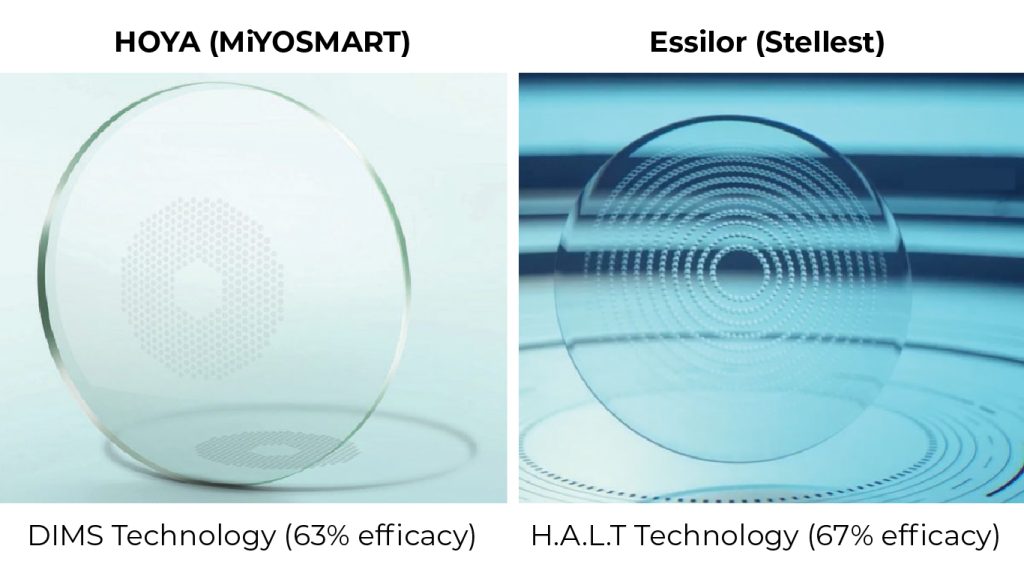 Myopia Control Lenses