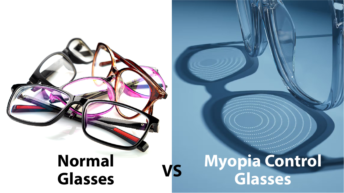 Normal Glasses VS. Myopia Control Glasses - Rx Optometry
